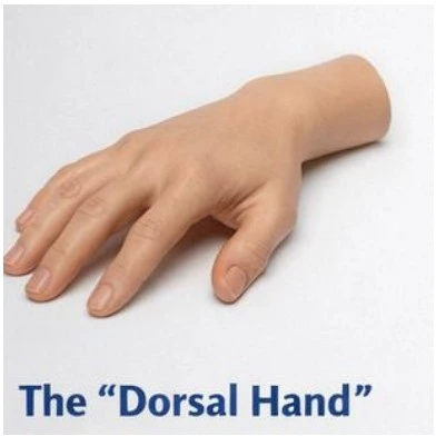 Dorsal Hand